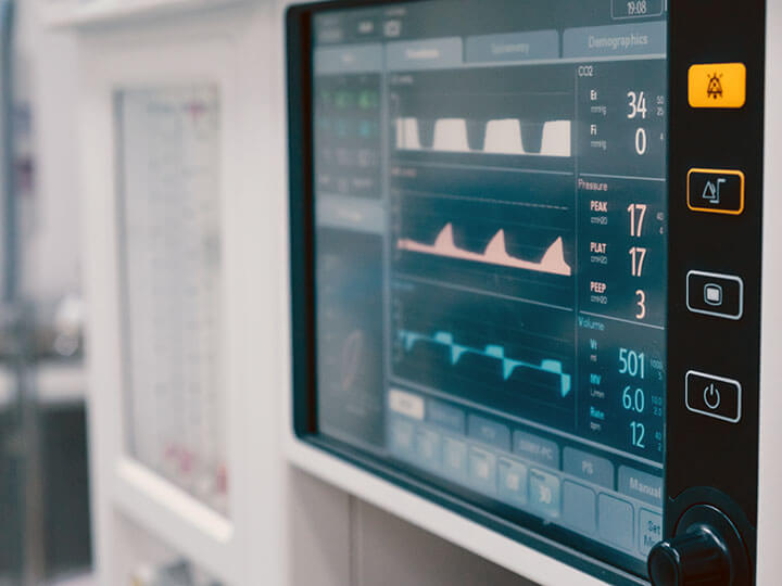 A medical monitor showing vital signs in an operating room at a hospital